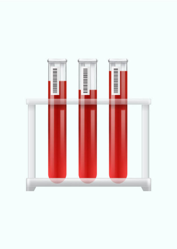 Collection Tubes