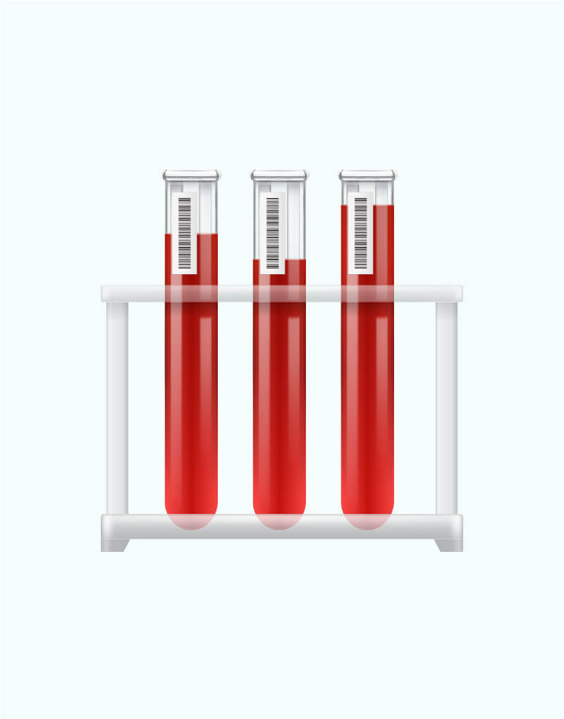 Collection Tubes